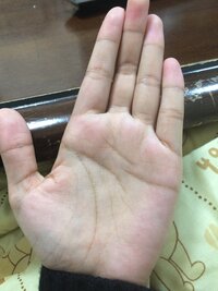 手のシワが多くとても濃いため小さい頃からおばあちゃんと見る人に言われコンプ Yahoo 知恵袋