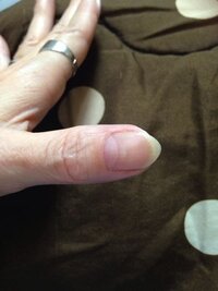 画像有 ジェルをオフした時の私の爪なのですが こんなに真っ Yahoo 知恵袋