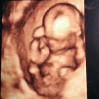 15w妊婦健診時いただいた4dエコー写真をみて足の間にあるのは男の子のシンボ Yahoo 知恵袋