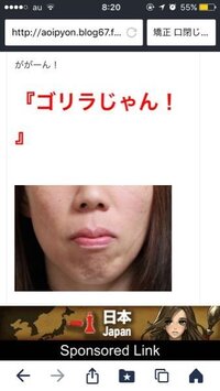 歯科矯正してる女とキスは気持ち悪いですか 高校生の女です 最近初め Yahoo 知恵袋