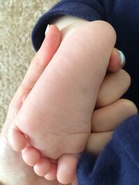 新生児 足の裏の膨らみについて もうすぐ１ヶ月になる子供の足の裏に左右 Yahoo 知恵袋