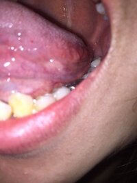ガンより怖い 癌かもしれない症候群 友佳子の 生きてるだけでおいしいの
