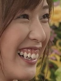 美人な芸能人に出っ歯な人がいます 笑うと歯茎が出てしまうような 例え Yahoo 知恵袋