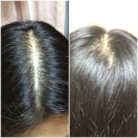 縮毛矯正をしに美容院にいきたいのですが抜毛症で髪の毛が薄いところがあり行き Yahoo 知恵袋
