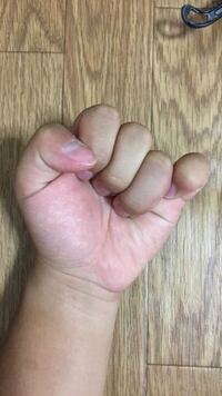 弓道をやっている高校生です 生まれつきなのかわからないのです Yahoo 知恵袋