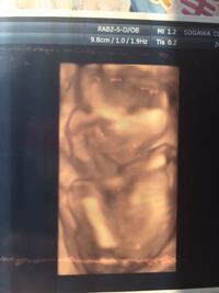 19週の赤ちゃんについて 4dエコーなのですが頭が大きく見え Yahoo 知恵袋