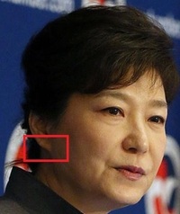 朝鮮耳で悩んでいます 朝鮮耳の人は朝鮮人だと良く聞くのですが Yahoo 知恵袋