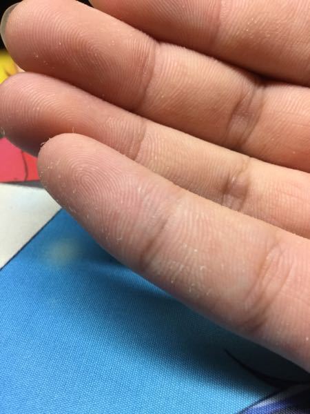 水虫 解決済みの質問 Yahoo 知恵袋