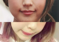 口角を自然にあげる方法 私は口角がうまく上がらず 写真の上のよ Yahoo 知恵袋