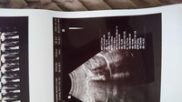22週のエコー写真の見方と胎児の大きさについて正確には21週6日な Yahoo 知恵袋