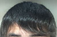 この写真の通り前髪がうねりまくって めちゃくちゃ嫌なんですが 1日まっすぐに Yahoo 知恵袋