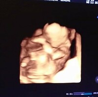 マタニティブルー ダウン症への不安現在妊娠6ヶ月の初マタです 胎 Yahoo 知恵袋