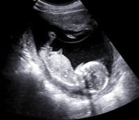 性別判断お願いします 現在妊娠8ヶ月ですが 性別がわからないままです 先日 Yahoo 知恵袋