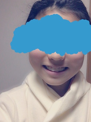 汚い写真ですいません高校生女子です 昔から頬肉が分厚く顔がパンパンで大きいこ Yahoo 知恵袋