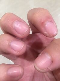 食器洗いのバイトを長期でやったことのある方にお聞きします やはり手荒れは Yahoo 知恵袋