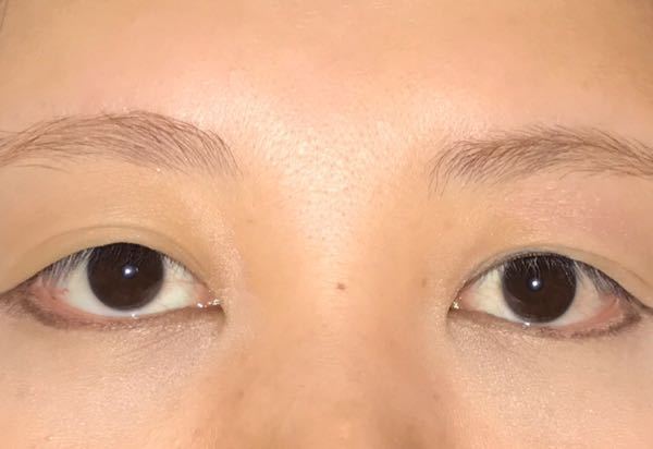 斜視の自己チェックをして見ました フラッシュたいてスマホで撮影しました Yahoo 知恵袋