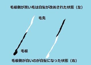 爪レベルに硬い何かが眉毛に生えてました しかも白いです 最初 Yahoo 知恵袋