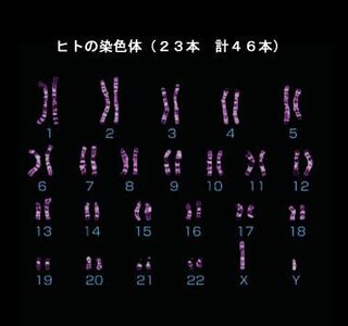 両性具有児の染色体の23番目はどういう形をしているのでしょうか も Yahoo 知恵袋