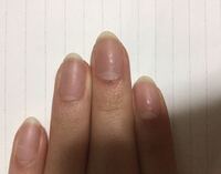 この爪の切り方 は変ですか 先がちょっと尖ってる感じ Yahoo 知恵袋