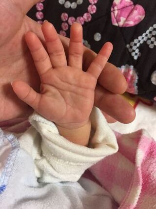ベストコレクション 赤ちゃん 猿線とは あなたのための赤ちゃんの画像