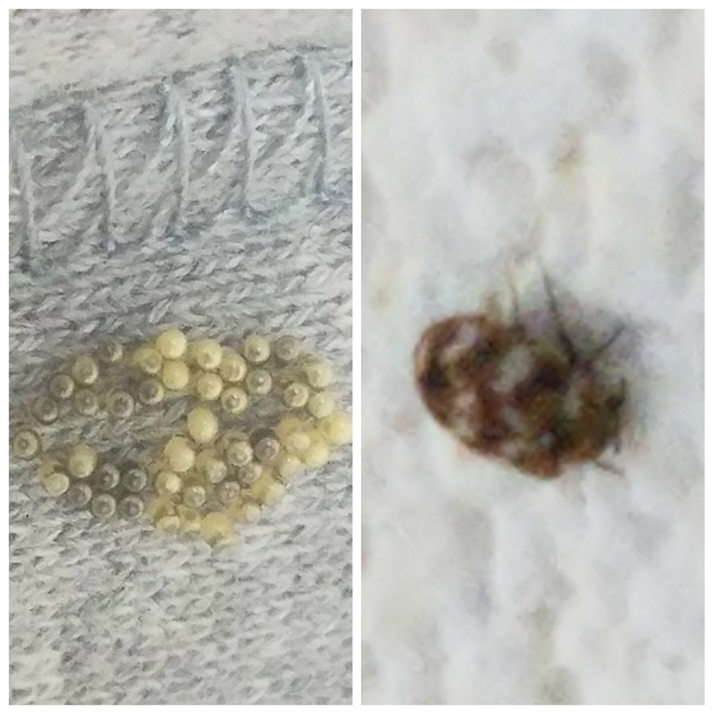 洗濯物 黒い 粒 卵(01)