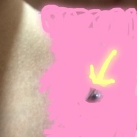 昨日違和感を感じみてみると外陰部 に黒いイボのようなものがありました 痒みは Yahoo 知恵袋