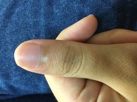 私の爪には爪半月がありません どの指にもありません 何年か前は親指に少しだけ Yahoo 知恵袋