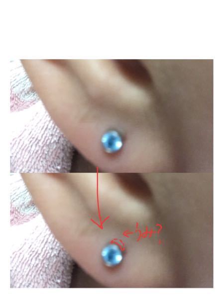 高校一年女子です。 - 至急回答お願いします(泣)2週間前にピアス