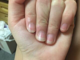 写真付きです ピンク色の部分が少なくて困ってます 見栄えも悪いし衛星的 Yahoo 知恵袋