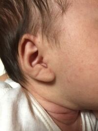 子供が耳を触る癖 吸う癖について 現在２歳３ヶ月の女の Yahoo 知恵袋