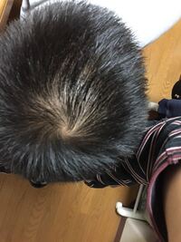 これは薄毛でしょうか 現在高校2年です 髪を太くする方法教えてくだ Yahoo 知恵袋