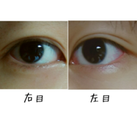 目が左右非対称で悩んでいます 写真でみるとかなり違和感がありますアイプチと Yahoo 知恵袋
