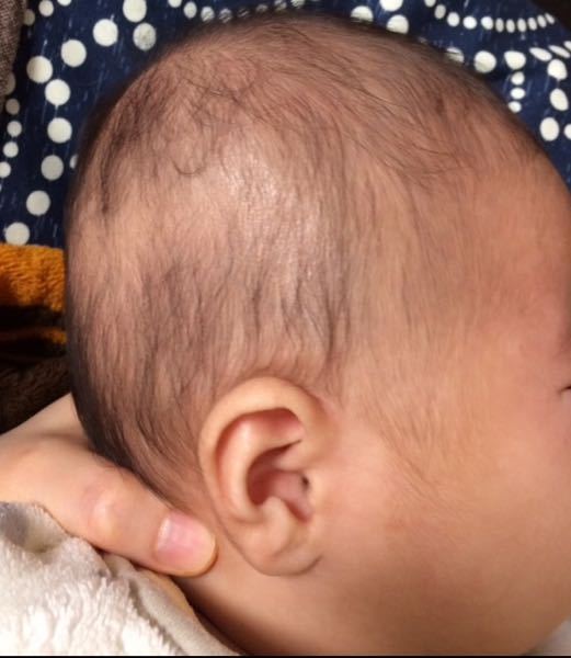 人気のコレクション 赤ちゃん で こっ ぱち