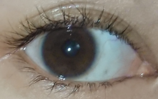 ダウンロード 目の周り 青い 目の周り 青い 原因