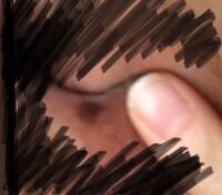 写真ありです 小陰部にホクロ があります シミのようにも Yahoo 知恵袋