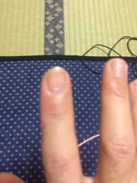 数日前から右手の人差し指の爪に白い点のようなものが現れて困惑しています 一体 Yahoo 知恵袋