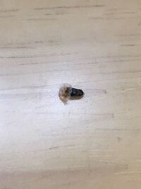 閲覧注意 頭皮のかさぶたを取ったら変な黒くてかたい物体が付いてきました Yahoo 知恵袋