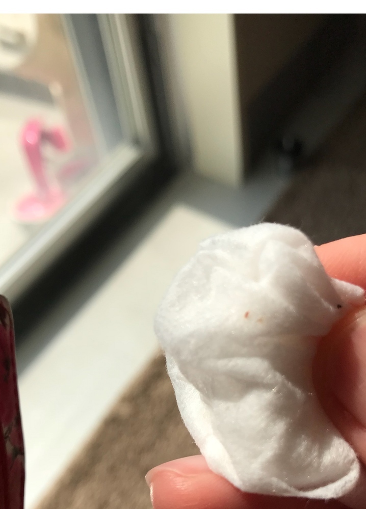 1mmにも満たない赤茶色した虫が窓のサッシ辺りによく出ます どんな虫か分かる Yahoo 知恵袋