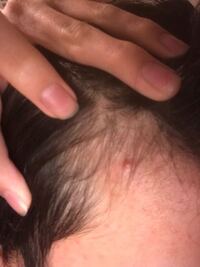 髪が細いとハゲるというのは本当ですか 髪質はサラサラでよく褒められるの Yahoo 知恵袋