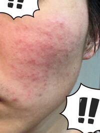 化粧水ってつけても無意味って皮膚科医が言っていたんですけど本当ですか Yahoo 知恵袋