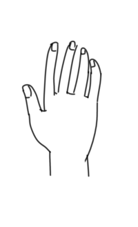 右手の指が 親指が左 人差し指と中指が右 薬指と小指が左側に曲がっ Yahoo 知恵袋