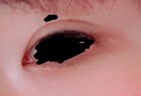 目が離れていて 蒙古襞があるので切開ラインも書けないです こういう Yahoo 知恵袋