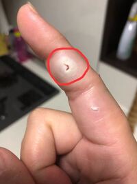 グロイ画像で申し訳ありません うちの猫に思いっきり噛まれてか Yahoo 知恵袋