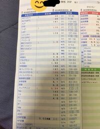 アル中ではないですが毎日お酒を飲んでます 血液検査の結果 肝臓の数値が175 Yahoo 知恵袋