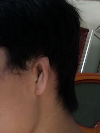 教えてください 男性26歳ですが耳が小さいすぎて だから彼女を会える時自 Yahoo 知恵袋