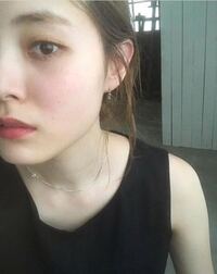 小鼻周りの赤みが気になります 赤みを直すケアなど教えて下さい 学校では化粧し Yahoo 知恵袋