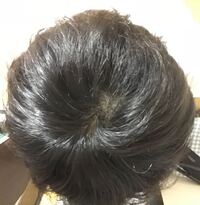 つむじが広がってきたのか 本当のつむじの位置が分からなくなりました これはプ Yahoo 知恵袋