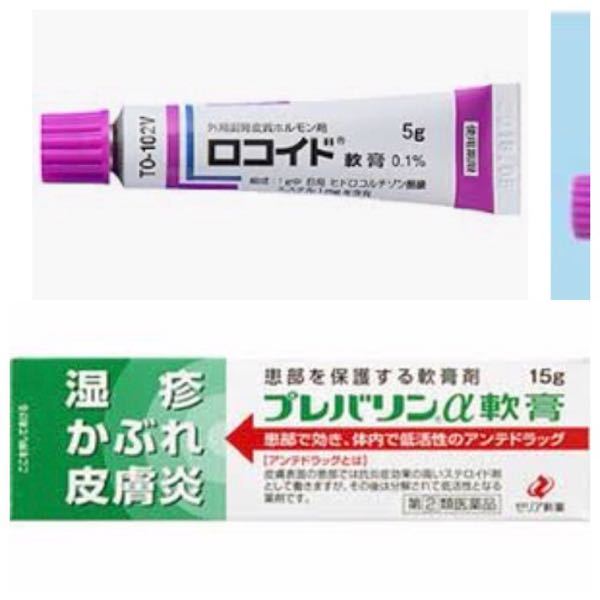 ロコイドクリーム 効果