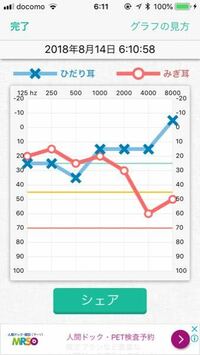 最近耳鳴りがするなぁと思ってアプリの聴力検査をしてみたんですが これって病院 Yahoo 知恵袋