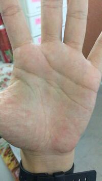 手の真ん中にある目のような形の線はファティマの目と呼ばれるものでしょうか Yahoo 知恵袋